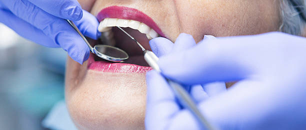 Best Emergency Dental Care for Broken or Chipped Teeth in Thomasboro, IL